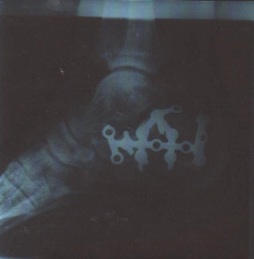 Sur une échelle de un à dix